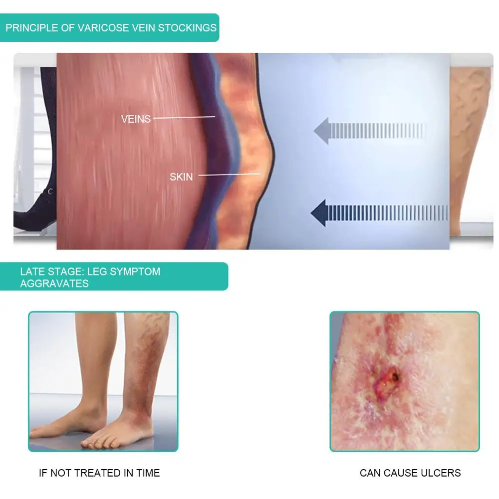 1Pair Medical Compression Sock - огляд і ціна Compression Sock Medical